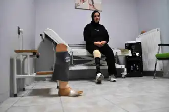 Azimli Anneye Yeni Umut: Yeni Protez